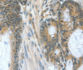 BAD Polyclonal Antibody – Figure 1 of 3