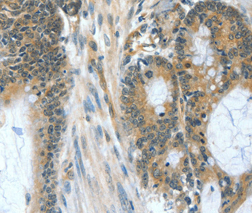 BAD Polyclonal Antibody – Figure 1 of 3