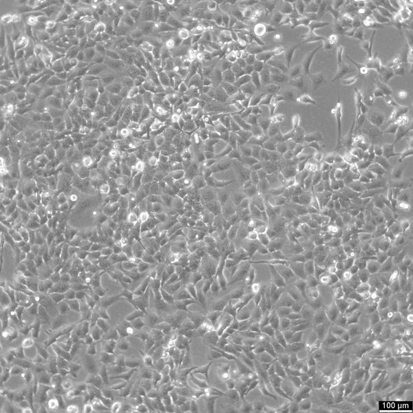 TTA1 cell