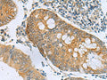 GUCA1A Polyclonal Antibody – Figure 1 of 3