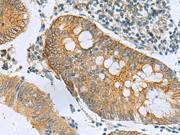GUCA1A Polyclonal Antibody – Figure 1 of 3