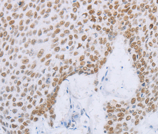 MCM2 Polyclonal Antibody – Figure 1 of 3