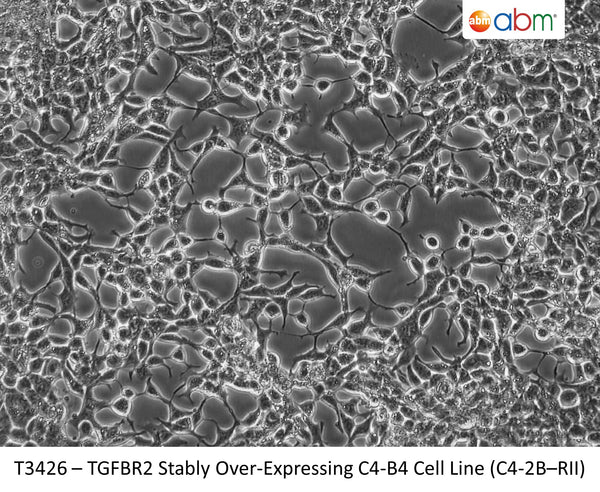 TGFBR2 Stably Over-Expressing C4-B4 Cell Line (C4-2B–RII) | Applied Biological Materials (abm)