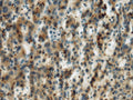 MICA Polyclonal Antibody – Figure 1 of 2