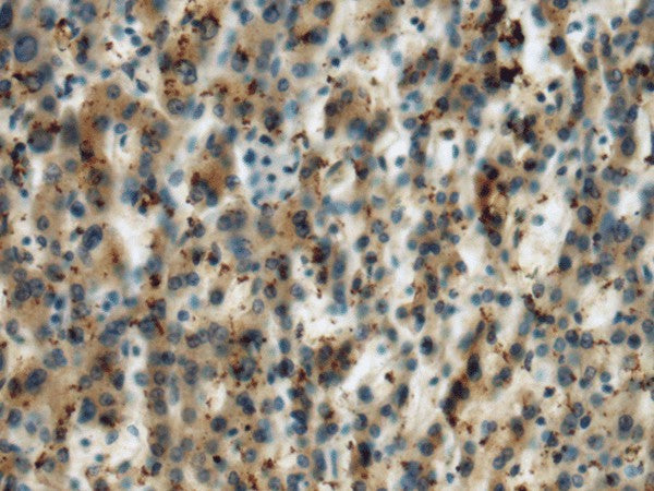 MICA Polyclonal Antibody – Figure 1 of 2