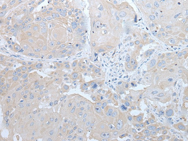 IFNB1 Polyclonal Antibody – Figure 1 of 3
