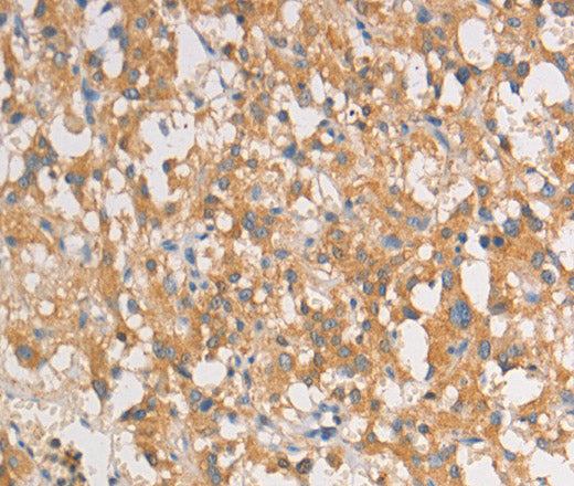 ART3 Polyclonal Antibody – Figure 1 of 2