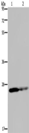 GSTP1 Polyclonal Antibody – Figure 1 of 4