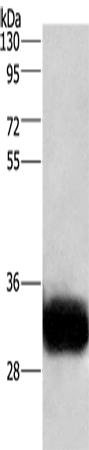 GPM6A Polyclonal Antibody – Figure 1 of 4