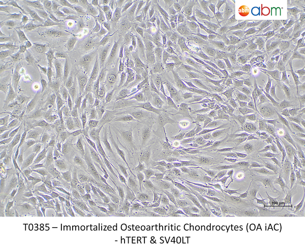Immortalized Osteoarthritic Chondrocytes (OA iAC)- hTERT & SV40LT – Figure 1 of 1