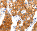 GLUT-4 Polyclonal Antibody – Figure 1 of 3