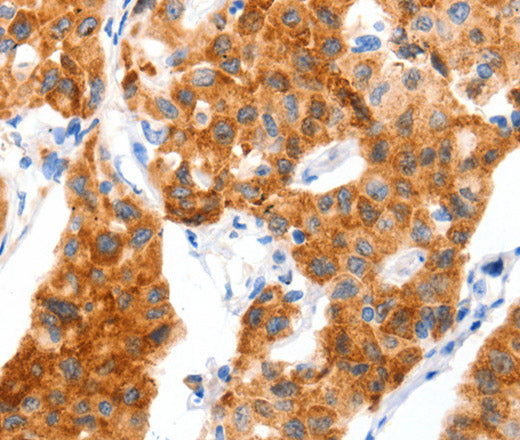 GLUT-4 Polyclonal Antibody – Figure 1 of 3