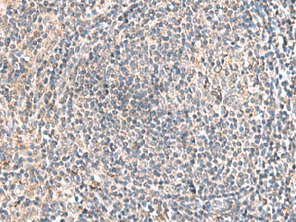 HLA-DOB Polyclonal Antibody – Figure 1 of 2