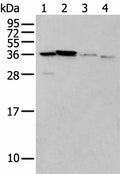 LASP1 Polyclonal Antibody – Figure 1 of 3
