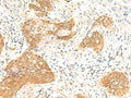 TBPL1 Polyclonal Antibody – Figure 1 of 3