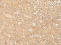 LGALSL Polyclonal Antibody – Figure 1 of 3