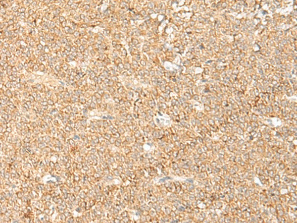 LGALSL Polyclonal Antibody – Figure 1 of 3