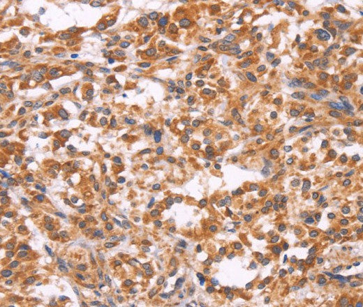 EMP2 Polyclonal Antibody – Figure 1 of 3