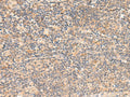 TEAD3 Polyclonal Antibody – Figure 1 of 3