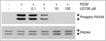 U0126 – Figure 1 of 2