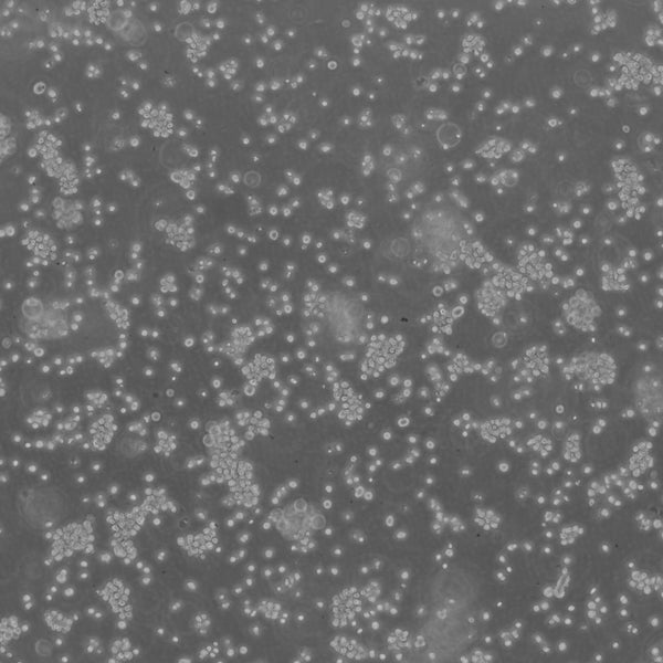 U266 cell