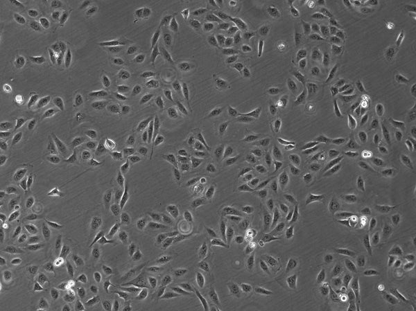 U2OS-CRISPR-SNAPf-Nup133 cell – Figure 1 of 1