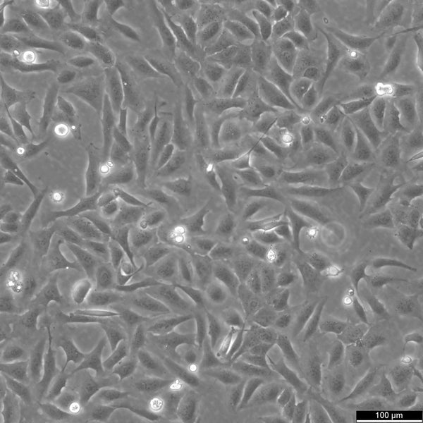U2OS cell