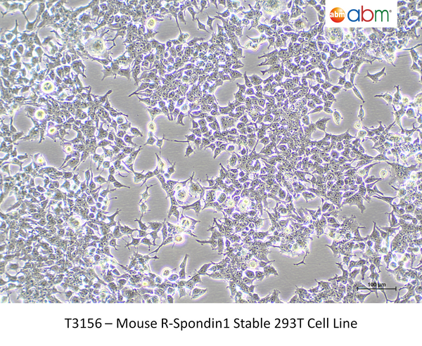 Mouse R-Spondin1 Stable 293T Cell Line – Figure 1 of 1