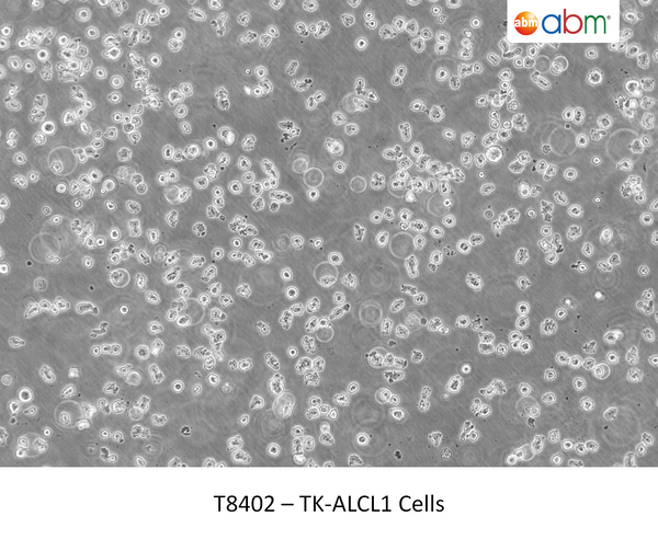 TK-ALCL1 Cells | Applied Biological Materials (abm)