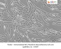 Immortalized NF1 Plexiform Neurofibroma Cell Line (ipNF08.1.5) - hTERT – Figure 1 of 1