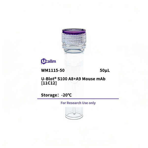 U-Blot® S100 A8+A9 Mouse Monoclonal Antibody (11C12) – Figure 1 of 1