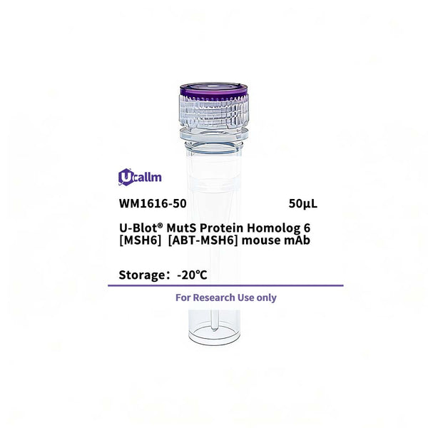 U-Blot® MutS Protein Homolog 6(MSH6) (ABT-MSH6) Mouse Monoclonal Antibody (WM1616) – Figure 1 of 1