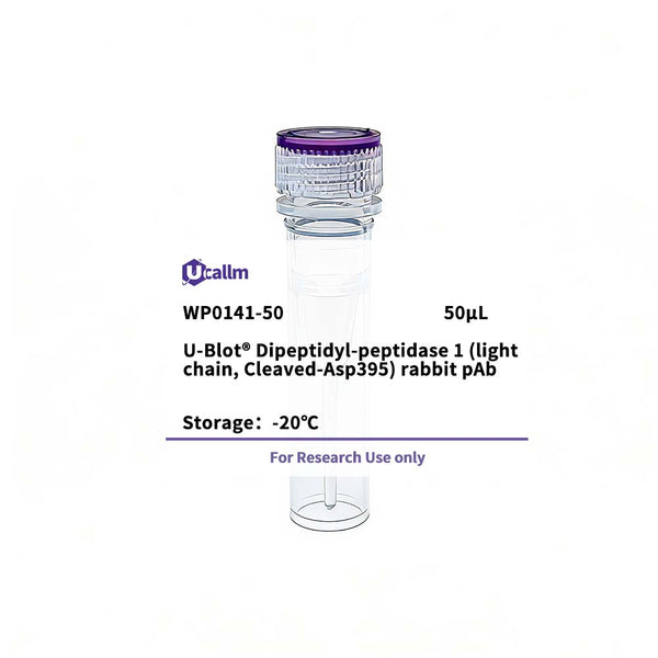 U-Blot® Dipeptidyl-peptidase 1 (light chain, Cleaved-Asp395) Rabbit Polyclonal Antibody – Figure 1 of 1