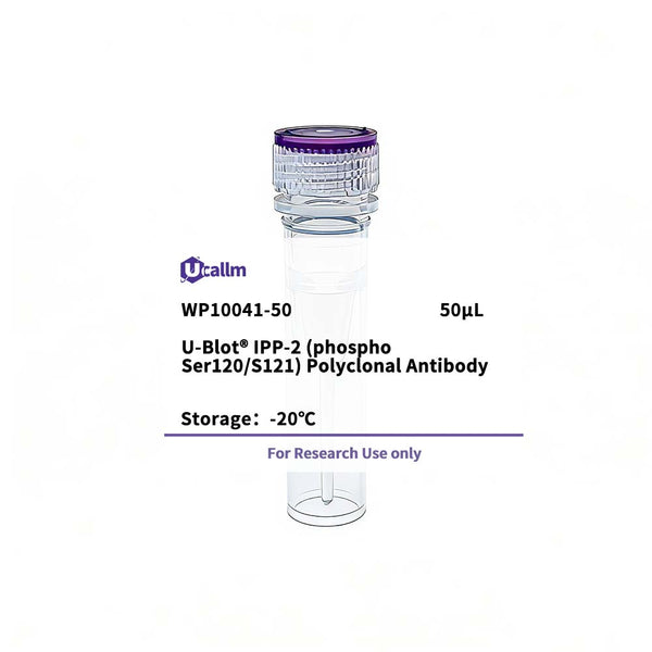 U-Blot® IPP-2 (Phospho Ser120/S121) Rabbit Polyclonal Antibody – Figure 1 of 1