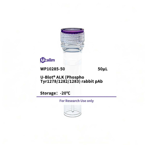 U-Blot® ALK (Phospho Tyr1278/1282/1283) Rabbit Polyclonal Antibody – Figure 1 of 1