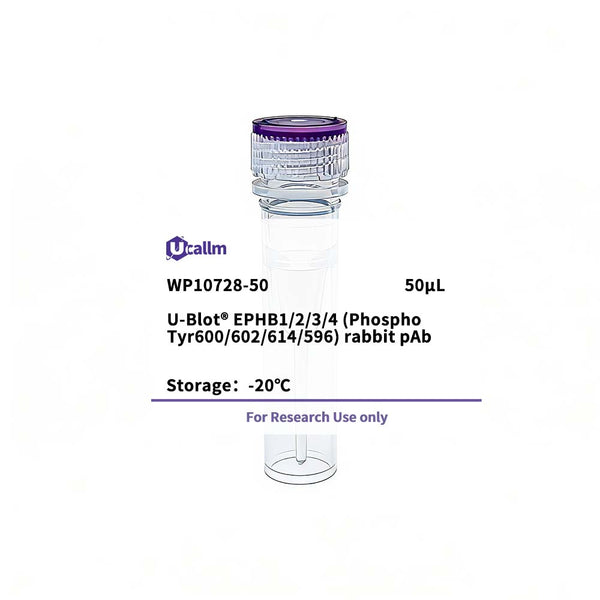 U-Blot® EPHB1/2/3/4 (Phospho Tyr600/602/614/596) Rabbit Polyclonal Antibody – Figure 1 of 1