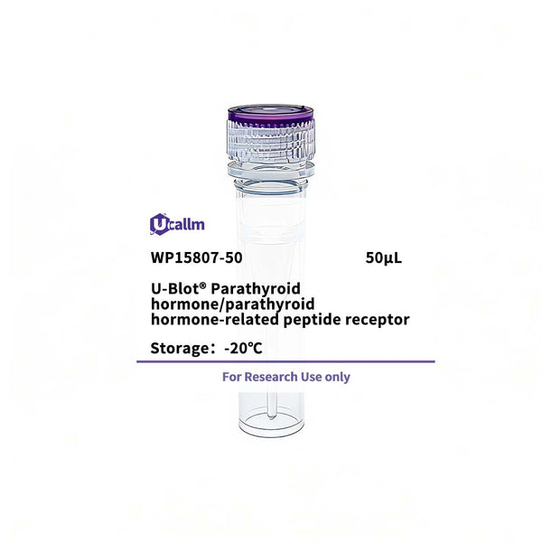 U-Blot® Parathyroid hormone/parathyroid hormone-related peptide receptor Rabbit Polyclonal Antibody – Figure 1 of 1