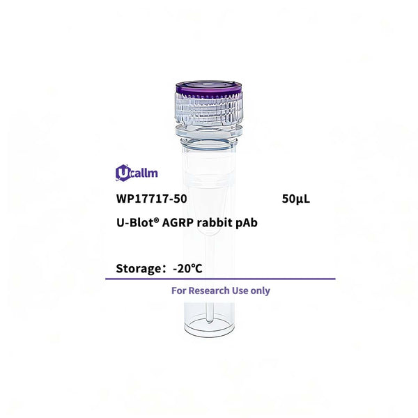 U-Blot® AGRP Rabbit Polyclonal Antibody (WP17717) – Figure 1 of 1