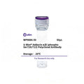 U-Blot® Adducin α/β (Phospho Ser726/713) Rabbit Polyclonal Antibody – Figure 1 of 1