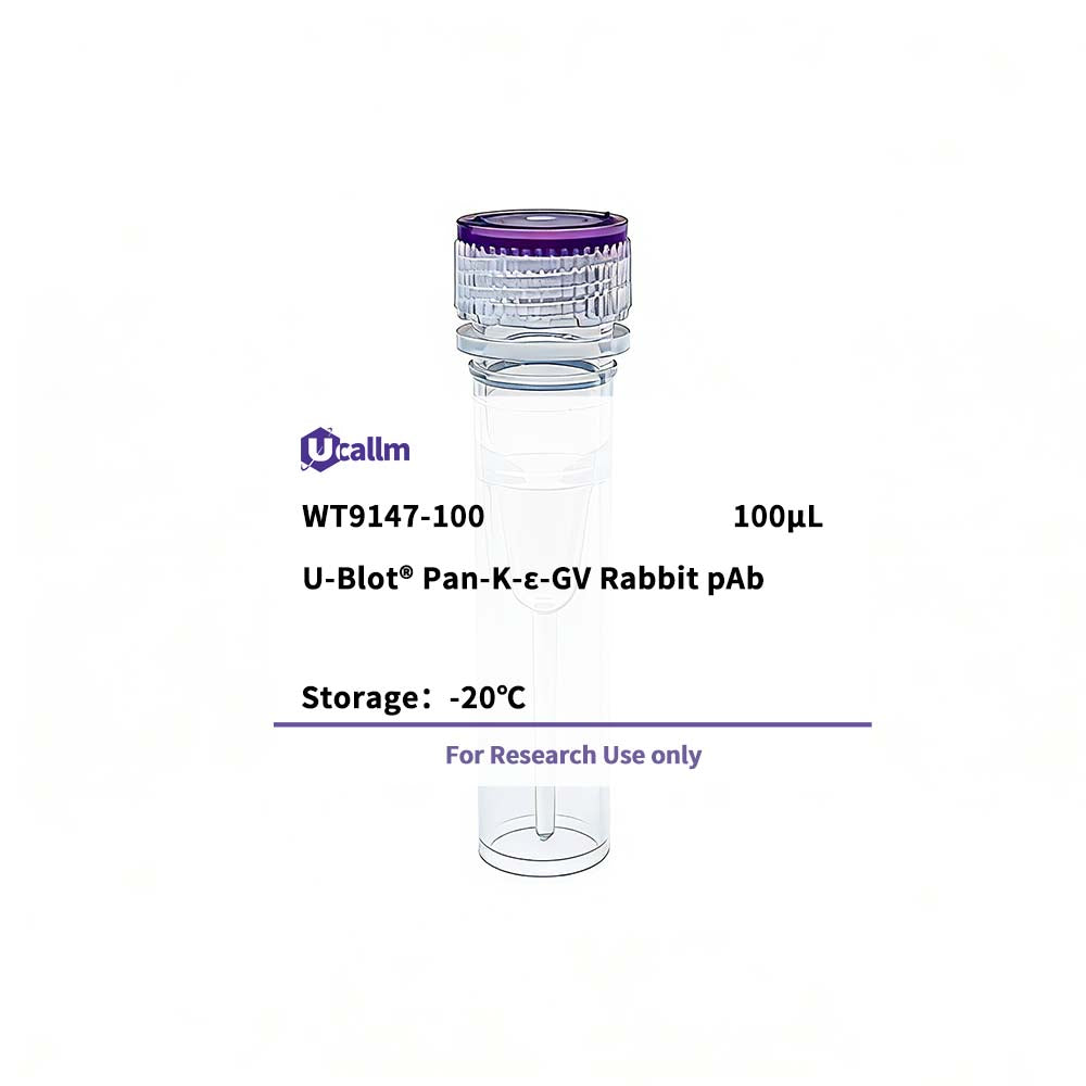 K-ε-GV motif Antibody (Rabbit) | Available through Biohippo – BioHippo