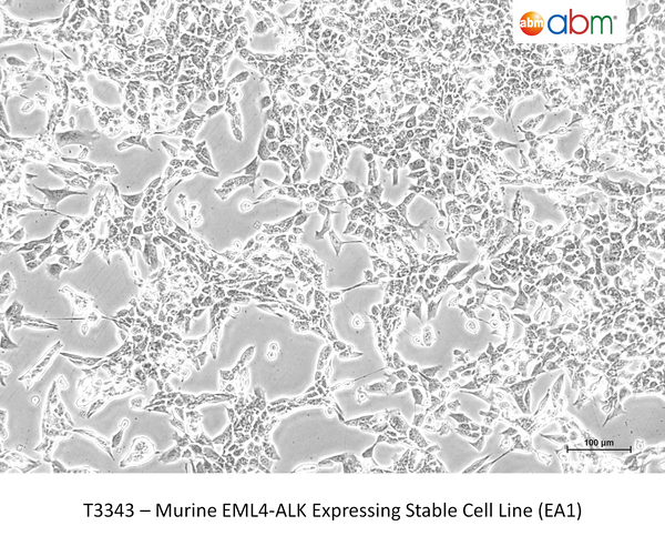 Murine EML4-ALK Expressing Stable Cell Line (EA1) – Figure 1 of 1