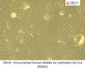 Immortalized Human Middle Ear Epithelial Cell Line (ROM2) | Applied Biological Materials (abm)