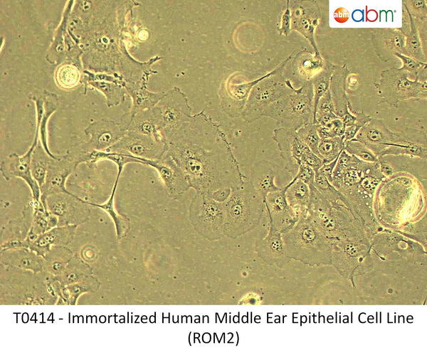 Immortalized Human Middle Ear Epithelial Cell Line (ROM2) | Applied Biological Materials (abm)