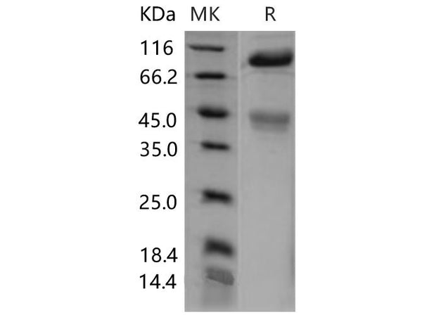 Recombinant Mouse c-MET/HGFR Protein (His Tag) – Figure 1 of 2