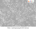Cas9 Expressing SH-SY5Y Cell Line | Applied Biological Materials (abm)