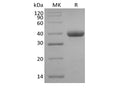 Recombinant Human IgG3 Fc – Figure 1 of 2