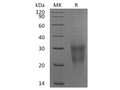Recombinant Human NKG2D/CD314 Protein (His Tag) – Figure 1 of 2