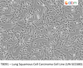 Lung Squamous Cell Carcinoma Cell Line (UN-SCC680) – Figure 1 of 1