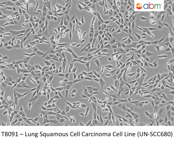 Lung Squamous Cell Carcinoma Cell Line (UN-SCC680) – Figure 1 of 1