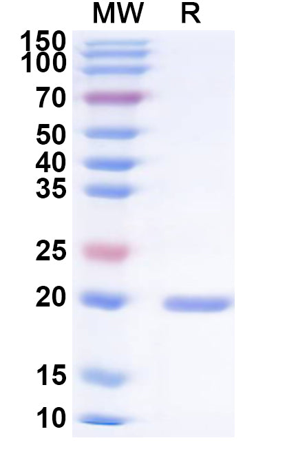 Recombinant Tobacco mosaic virus(TMV) Capsid/Coat protein, N-His